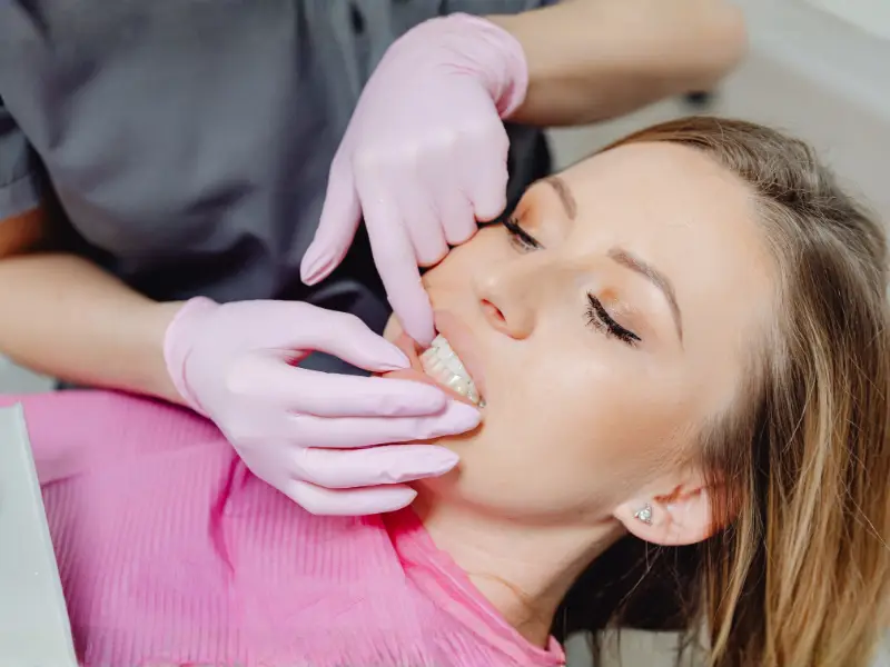 Fissure sealant treatment at Levin Dental Centre protecting teeth from decay and maintaining optimal oral health for patients