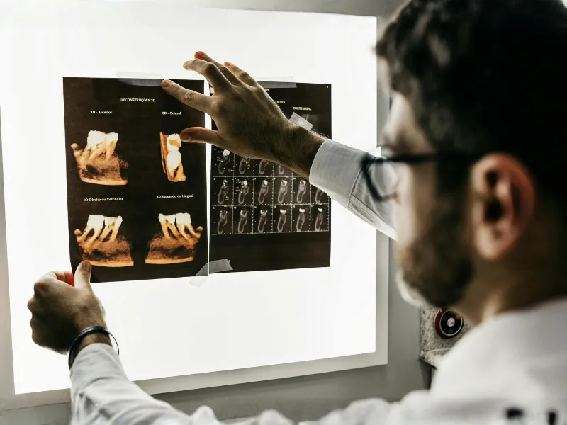 Accident and trauma dental repair at Levin Dental Centre restoring damaged teeth with expert emergency dental care in Levin