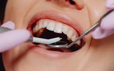 Dental Implants in Levin – Cost, Procedure & Benefits