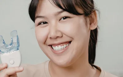 Professional Teeth Whitening in Levin – Safe and Effective Options