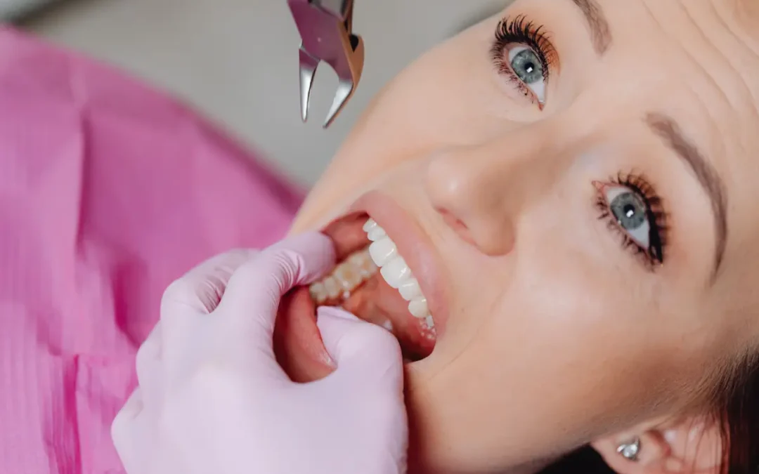 Patient experiencing wisdom tooth pain before urgent dental treatment in Levin