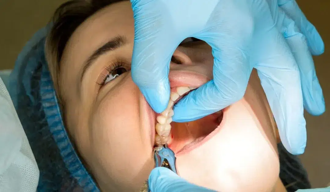 Wisdom teeth removal cost in New Zealand explained with pricing factors, treatment options and dental care guidance.