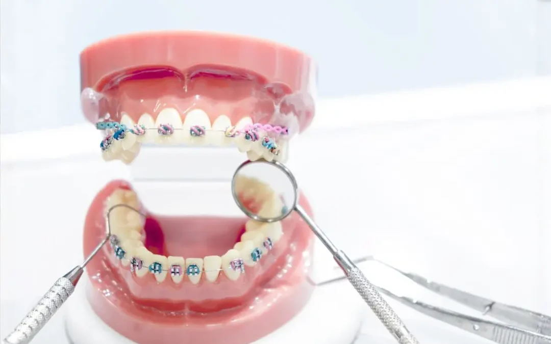 orthodontic treatment levin