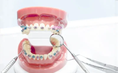 Orthodontic Treatment Levin: Braces, Invisalign & Clear Aligners Guide